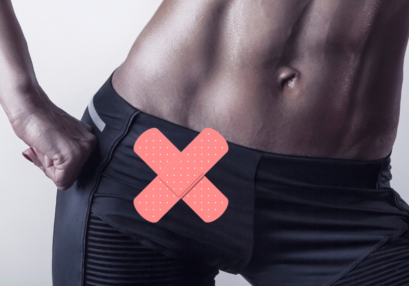 Σχηματική απεικόνιση κήλης αθλητή